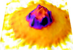 leucocyte with stiffness color overlay