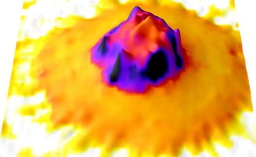 leucocyte with stiffness color overlay